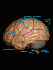Brain - Lateral View
