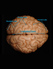 Brain - Superior View