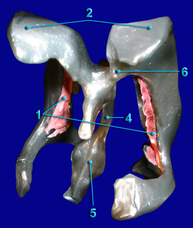 Cerebra Ventricle - Anterior View