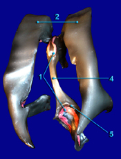 Ventricles - Posterior 