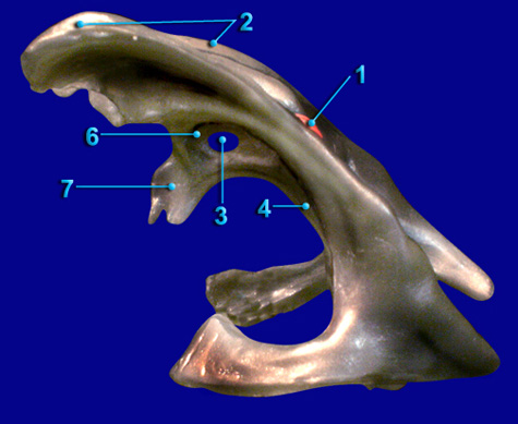 Cerebral Ventricle - Lateral View