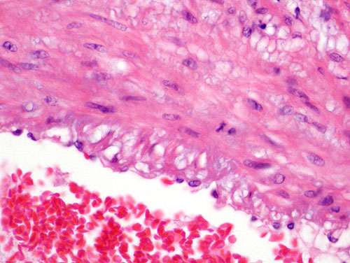 smooth muscle slide