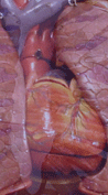 Cardiovascular
